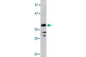 Western blot analysis of MYD88 in Jurkat whole cell lysate with MYD88 polyclonal antibody  at 1 : 500 dilution. (MYD88 anticorps  (AA 233-248))