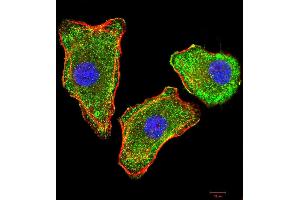 Immunofluorescence analysis of MCF-7 cells using TTR mouse mAb (green).