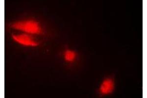 Immunofluorescent analysis of Cytokeratin 14 staining in MCF7 cells.