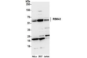 Western Blotting (WB) image for anti-RNA Binding Motif Protein 42 (RBM42) (AA 430-480) antibody (ABIN7450643)
