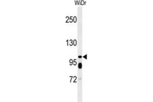 Western Blotting (WB) image for anti-ATP-Binding Cassette, Sub-Family C (CFTR/MRP), Member 11 (ABCC11) antibody (ABIN5021768) (ABCC11 anticorps)