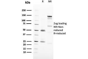 SDS-PAGE Analysis Purified HER-2 Monospecific Mouse Monoclonal Antibody (ERBB2/3093). (ErbB2/Her2 anticorps  (AA 311-462))
