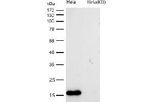 All lanes use the Antibody at 1:1K dilution for 1 hour at room temperature.