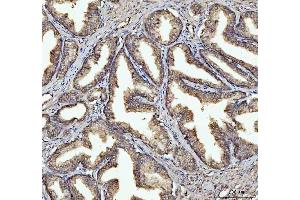 IHC analysis of GSDMD using anti-GSDMD antibody (ABIN7599431). (GSDMD anticorps  (AA 1-484))