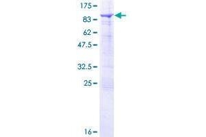 Image no. 1 for Sorting Nexin 33 (SNX33) (AA 1-574) protein (GST tag) (ABIN1320900)