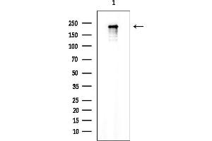 anti-Amyotrophic Lateral Sclerosis 2 (Juvenile) (ALS2) (N-Term) antibody