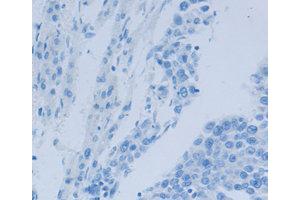 Immunohistochemistry (IHC) image for anti-Nephrosis 1, Congenital, Finnish Type (Nephrin) (NPHS1) antibody (ABIN1873932) (Nephrin anticorps)