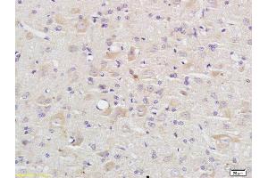 Formalin-fixed and paraffin embedded rat brain labeled with Anti Caspase-9 p10 Polyclonal Antibody, Unconjugated (ABIN1387603) at 1:200 followed by conjugation to the secondary antibody and DAB staining (Caspase 9 anticorps  (AA 351-416))