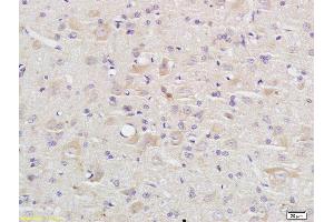 Formalin-fixed and paraffin embedded rat brain labeled with Anti Caspase-9 p10 Polyclonal Antibody, Unconjugated (ABIN1387603) at 1:200 followed by conjugation to the secondary antibody and DAB staining