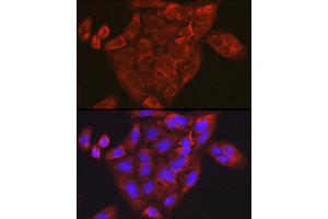 Immunofluorescence analysis of U-2 OS cells using CCL3 Rabbit pAb (ABIN6130184, ABIN6138061, ABIN6138062 and ABIN6223474) at dilution of 1:100 (40x lens).