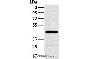 Western blot analysis of A375 cell, using MAGEA10 Polyclonal Antibody at dilution of 1:400 (MAGEA10 anticorps)