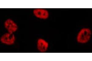 ABIN6276705 staining  Hela cells by IF/ICC. (RENT1/UPF1 anticorps)