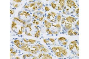 Immunohistochemistry of paraffin-embedded Human stomach using SDC4 Polyclonal Antibody at dilution of 1:100 (40x lens). (SDC4 anticorps)