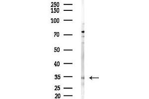 Western blot analysis of lysates from EC304 cells(starvation,24h treatment), using KLK3 Antibody at 1/1000 dilution.