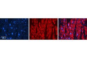 Rabbit Anti-GSTA4 Antibody   Formalin Fixed Paraffin Embedded Tissue: Human heart Tissue Observed Staining: Cytoplasmic Primary Antibody Concentration: N/A Other Working Concentrations: 1:600 Secondary Antibody: Donkey anti-Rabbit-Cy3 Secondary Antibody Concentration: 1:200 Magnification: 20X Exposure Time: 0.