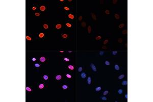 Immunofluorescence analysis of NIH/3T3 cells using Acetyl-Histone H2B-K5 antibody (ABIN7267733) at dilution of 1:100.