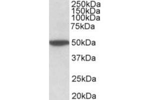 Western Blotting (WB) image for anti-Cholinergic Receptor, Muscarinic 2 (CHRM2) (Internal Region) antibody (ABIN2465137) (Muscarinic Acetylcholine Receptor M2 anticorps  (Internal Region))