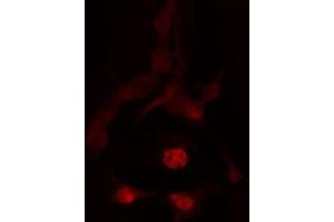 ABIN6272442 staining HeLa by IF/ICC. (TBX2 anticorps  (C-Term))