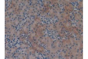 DAB staining on IHC-P; Samples: Mouse Ovary Tissue) (S100A6 anticorps  (AA 1-89))