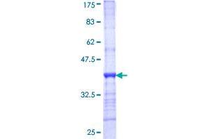 Image no. 1 for Carbamoyl-Phosphate Synthase 1, Mitochondrial (CPS1) (AA 1400-1500) protein (GST tag) (ABIN1350227)