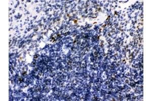 IHC testing of FFPE mouse spleen with IKAROS antibody. (IKZF1 anticorps)