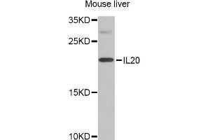 Western blot analysis of extracts of mouse liver, using IL20 Antibody.