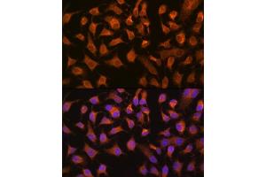 Immunofluorescence analysis of HeLa cells using PEPCK/PEPCK/PCK2 Rabbit mAb (ABIN7269306) at dilution of 1:100 (40x lens). (PEPCK anticorps)