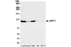 Western Blotting (WB) image for anti-Ubiquitin Specific Peptidase 11 (USP11) (AA 870-920) antibody (ABIN7450882)