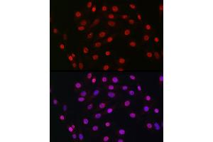 Immunofluorescence analysis of NIH/3T3 cells using HDGF Rabbit mAb (ABIN7267622) at dilution of 1:100 (40x lens). (HDGF anticorps)
