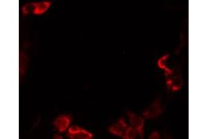 ABIN6274833 staining Hela by IF/ICC.