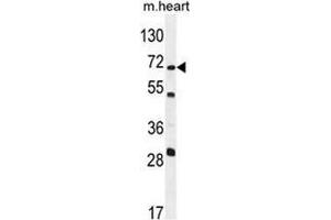 Western blot analysis in mouse heart tissue lysates (35ug/lane)using NT5C1B Antibody (N-term). (NT5C1B anticorps  (N-Term))