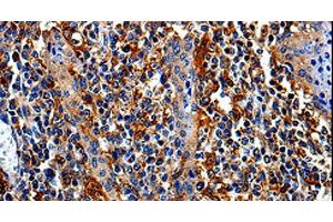Immunohistochemistry of paraffin-embedded Human tonsil tissue using COX16 Polyclonal Antibody at dilution 1:50 (COX16 anticorps)