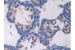 Detection of CD74 in Mouse Testis Tissue using Polyclonal Antibody to Cluster Of Differentiation 74 (CD74)