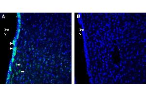 Expression of progranulin in rat hypothalamus.