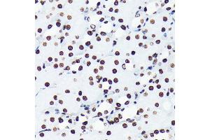 Immunohistochemistry of paraffin-embedded mouse kidney using Acetyl-Histone H4-K5 antibody (ABIN7267743) at dilution of 1:100 (40x lens). (Histone H4 anticorps  (acLys5))