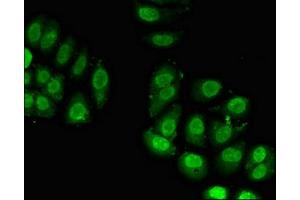 Immunofluorescent analysis of A549 cells using ABIN7142772 at dilution of 1:100 and Alexa Fluor 488-congugated AffiniPure Goat Anti-Rabbit IgG(H+L) (RPL23A anticorps  (AA 1-92))