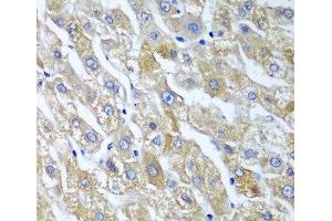 Immunohistochemistry of paraffin-embedded Human liver using SGSH Polyclonal Antibody at dilution of 1:100 (40x lens).