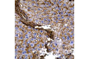 Immunohistochemistry of paraffin-embedded rat kidney using Caspase-8 Rabbit pAb (ABIN6131530, ABIN6137970, ABIN6137972 and ABIN6213676) at dilution of 1:200 (40x lens).