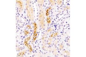 Immunohistochemistry of paraffin embedded mouse kidney using ASBT (ABIN7075648) at dilution of 1:1500 (400x lens) (SLC10A2 anticorps)