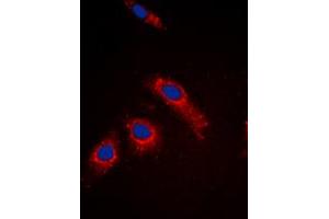 Immunofluorescent analysis of RPL3L staining in MCF7 cells.