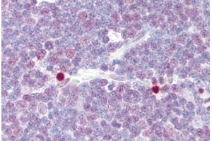 Anti-CREB1 / CREB antibody IHC staining of human thymus. (CREB1 anticorps  (AA 91-140))