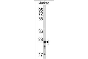 Western blot analysis in Jurkat cell line lysates (35ug/lane). (ARHGDIB anticorps  (C-Term))
