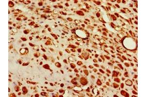 Immunohistochemistry of paraffin-embedded human placenta tissue using ABIN7171322 at dilution of 1:100 (T-Box 6 anticorps  (AA 295-436))