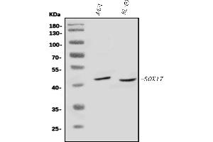 Western blot analysis of SOX17 using anti-SOX17 antibody (ABIN7599367).