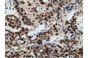 Immunohistochemical staining of paraffin-embedded Human colon tissue using anti-EPM2AIP1 mouse monoclonal antibody. (EPM2AIP1 anticorps)