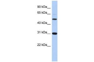 PI16 antibody used at 1 ug/ml to detect target protein.