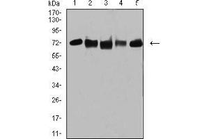 Western blot analysis using TRIM25 mouse mAb against MCF-7 (1), MCF-7 (2), K562 (3), A549 (4), and MOLT4 (5) cell lysate.