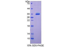 SDS-PAGE analysis of Rat Insulin Like Growth Factor Binding Protein 4 (IGFBP4) Protein. (IGFBP4 Protéine)