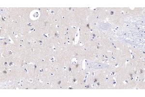 Detection of NPPB in Human Cerebrum Tissue using Polyclonal Antibody to Natriuretic Peptide Precursor B (NPPB)