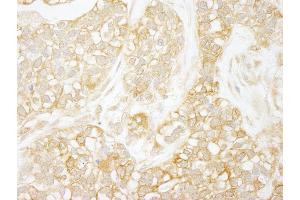 Immunohistochemistry (IHC) image for anti-Nuclear Factor-kB p65 (NFkBP65) (AA 501-551) antibody (ABIN7448771)